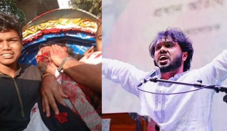 হাদির শারীরিক অবস্থার উন্নতি হলে নেওয়া হতে পারে বিদেশ