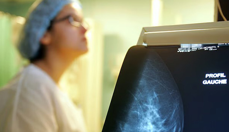 স্তন ক্যানসার শনাক্তে সহায়ক হতে পারে এআই