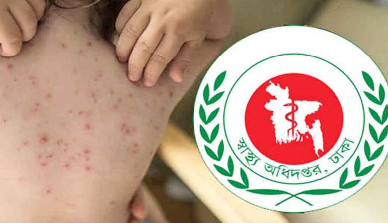 হামে শিশুমৃত্যু বাড়ছে উদ্বেগজনক হারে