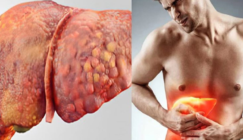লিভারের ক্ষতি করছে যেসব অভ্যাস: কীভাবে বাঁচবেন