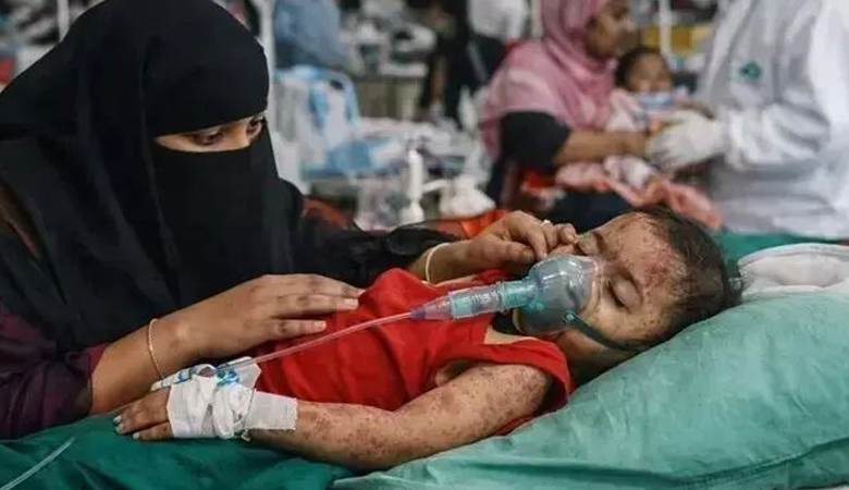 হাম ও হামের উপসর্গ নিয়ে আরো তিনজনের মৃত্যু