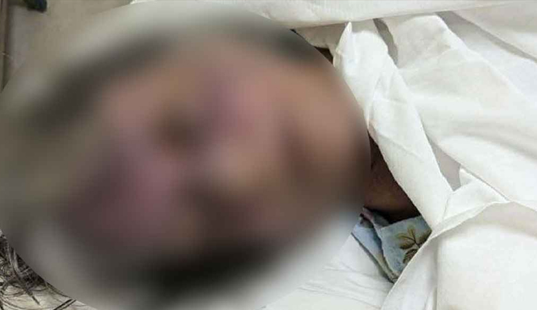 রাজধানীতে বিদেশি নাগরিককে পিটিয়ে হত্যার অভিযোগ