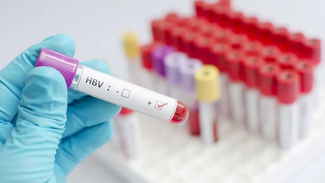 এক বছরে বিশ্বে হেপাটাইটিস বি কমেছে ৩২ শতাংশ
