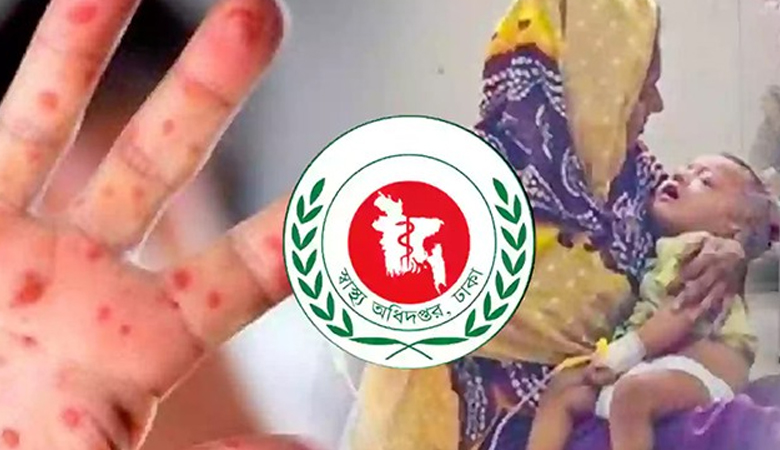 হামের উপসর্গ নিয়ে আরো ১০ শিশুর মৃত্যু