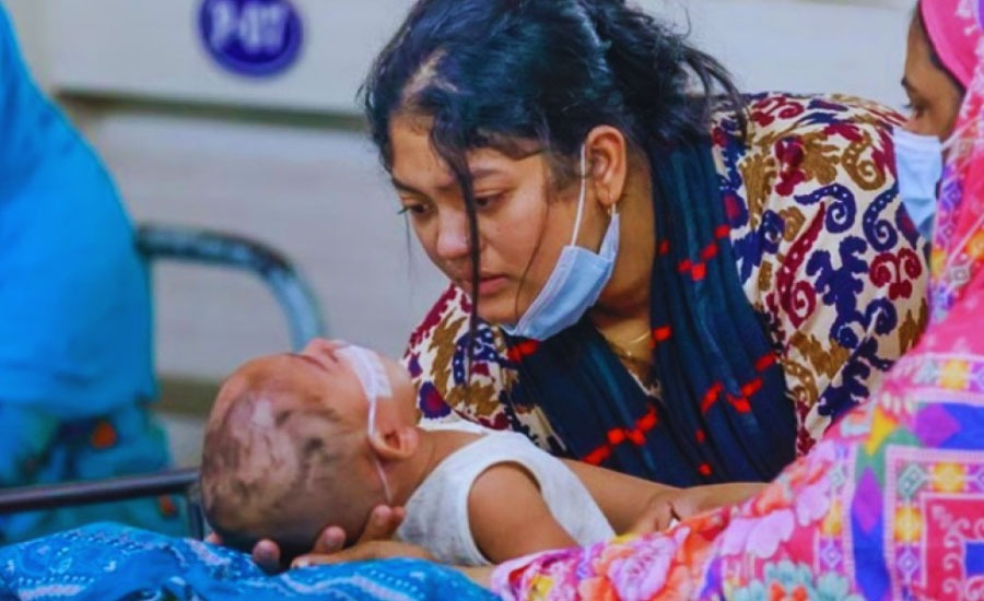 হাম ও উপসর্গে আরো ১১ শিশুর মৃত্যু, মোট ৪০৯