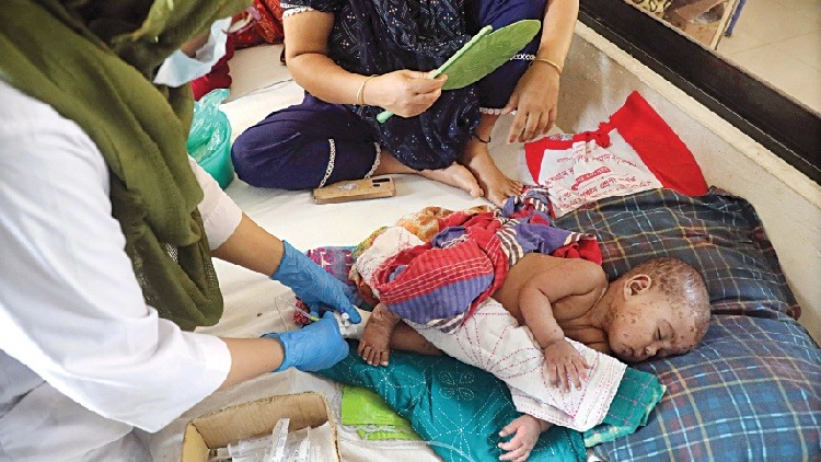 হাম ও উপসর্গে আরো ১০ শিশুসহ মৃতের সংখ্যা বেড়ে দাঁড়িয়েছে ৫৫৫
