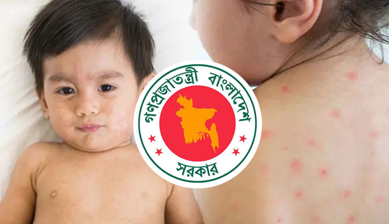 সারা দেশে হাম উপসর্গে আরো ৩ শিশুর মৃত্যু