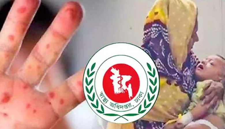 হাম উপসর্গ নিয়ে আরো ৪ শিশুর মৃত্যু