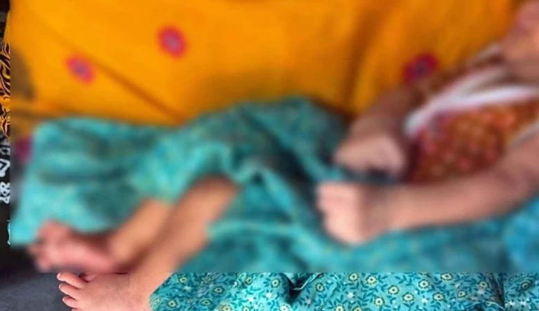 ২৮ আঙুল নিয়ে জন্ম নিলো দিনাজপুরের শিশু
