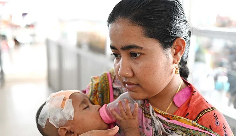 হাম উপসর্গে ১১ শিশুর মৃত্যু