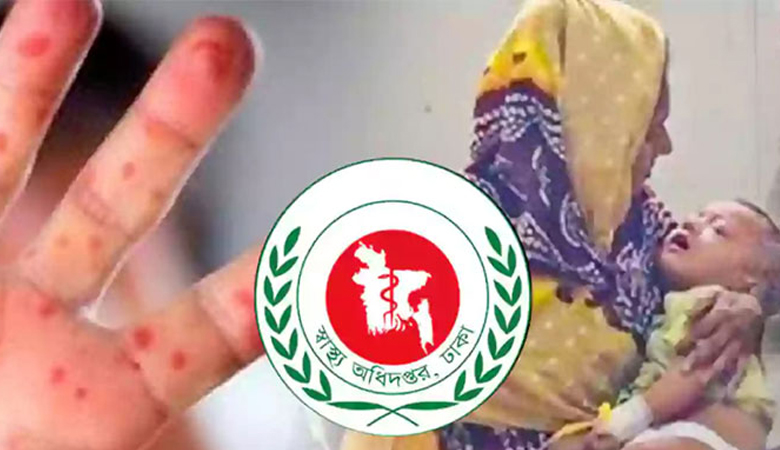 হামের উপসর্গ নিয়ে একদিনে আরো ৯ জনের মৃত্যু