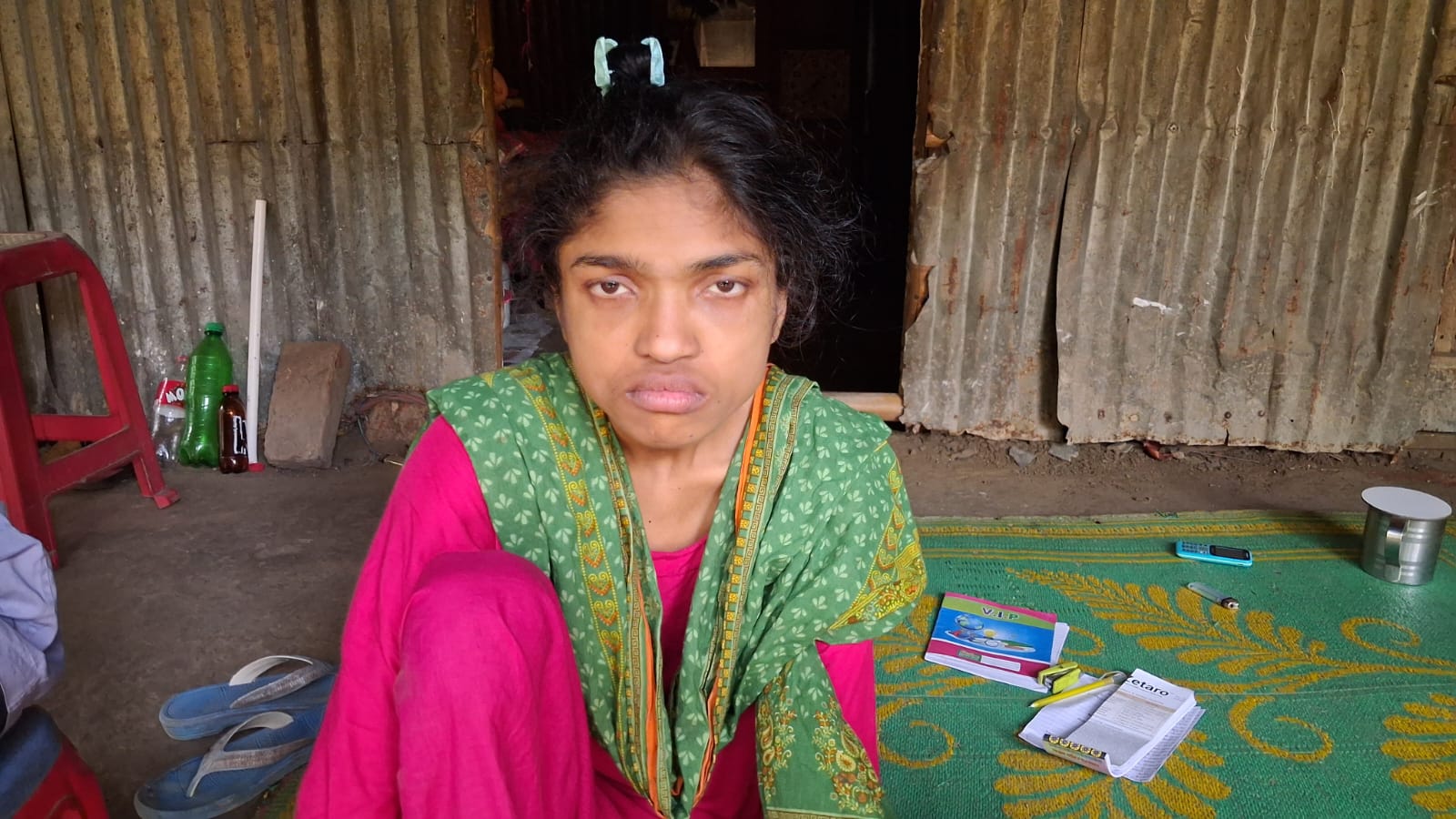 চিকিৎসার অর্থ নেই, বাবার চোখের সামনেই মৃত্যুঝুঁকিতে লামিয়া